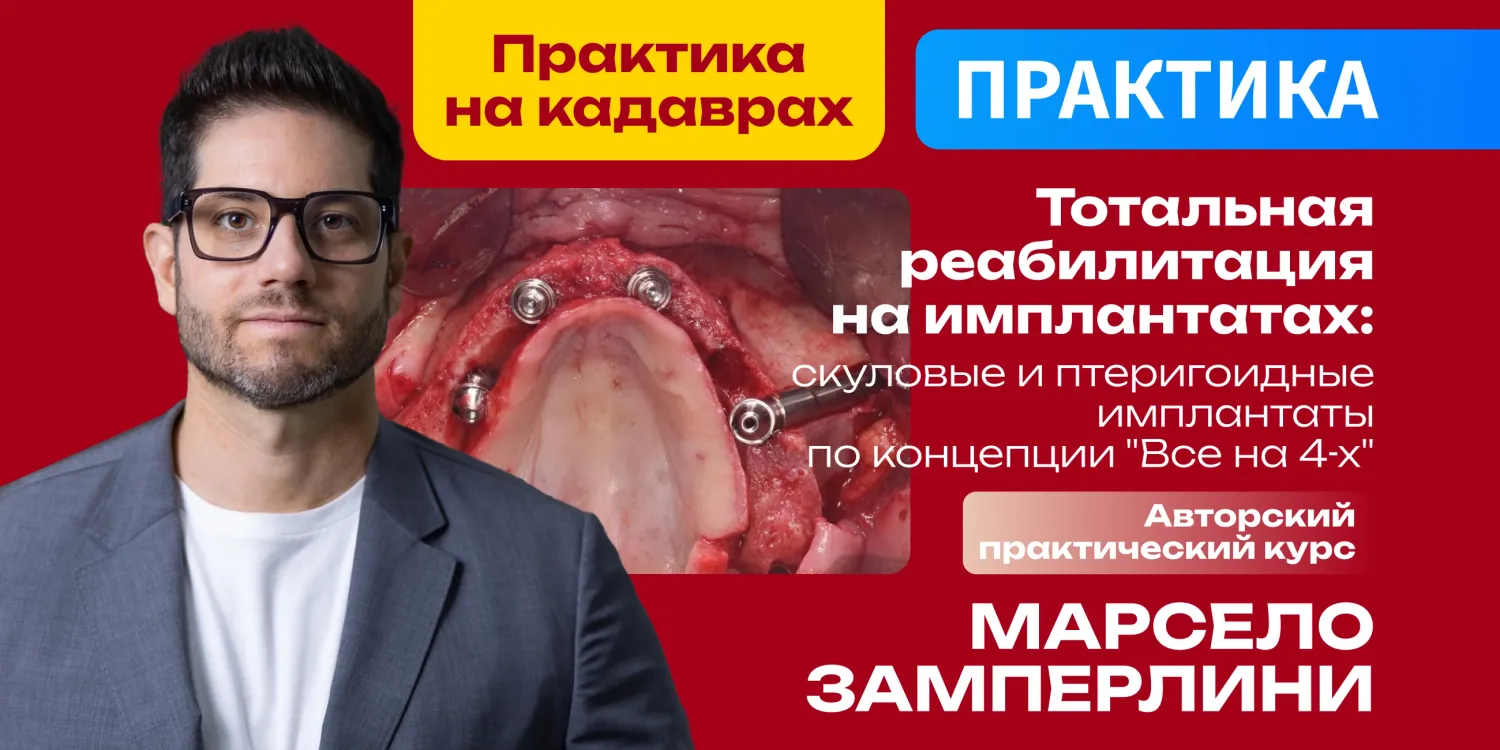 Тотальная реабилитация на имплантатах: скуловые и птеригоидные имплантаты по концепции "Все на 4-х"