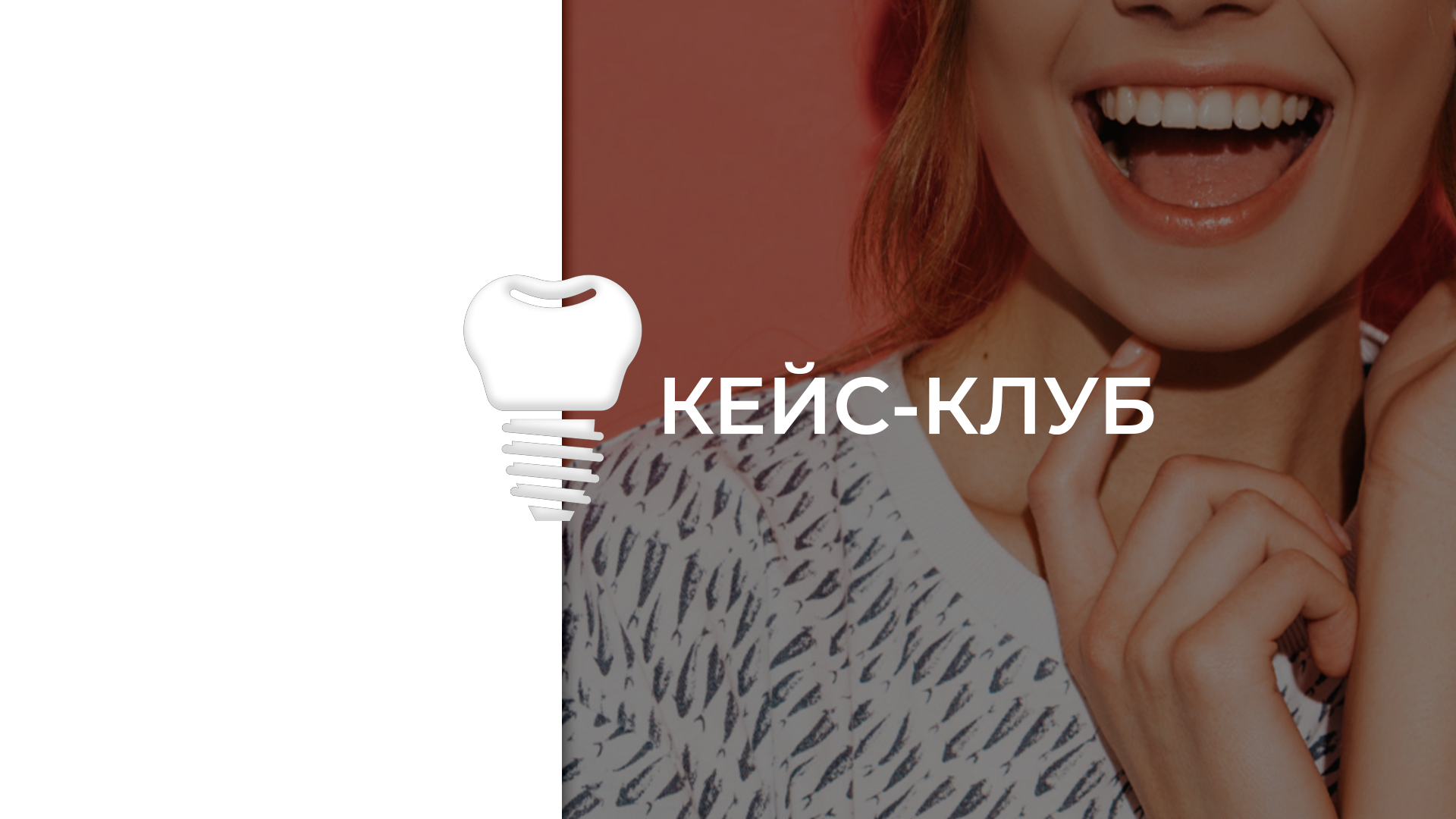 Кейс- клуб