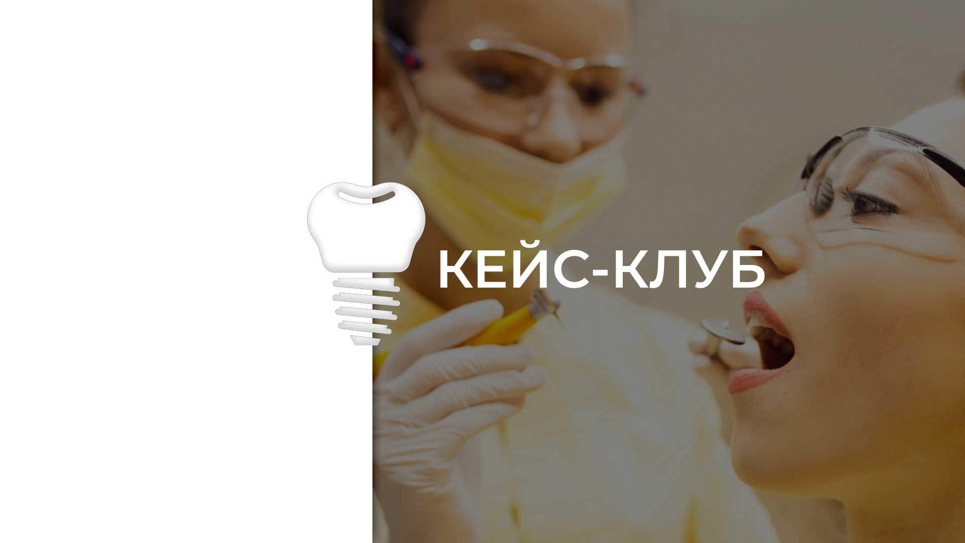 Кейс- клуб