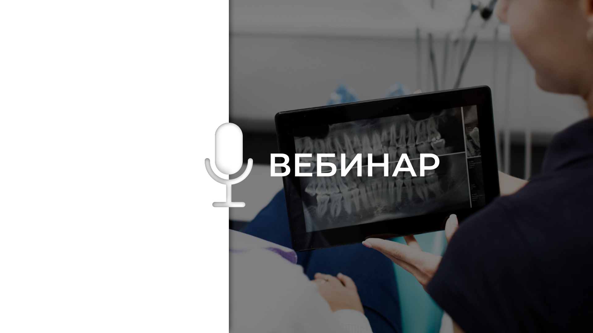 Съемная, цементная и винтовая фиксация. Что выбрать? 