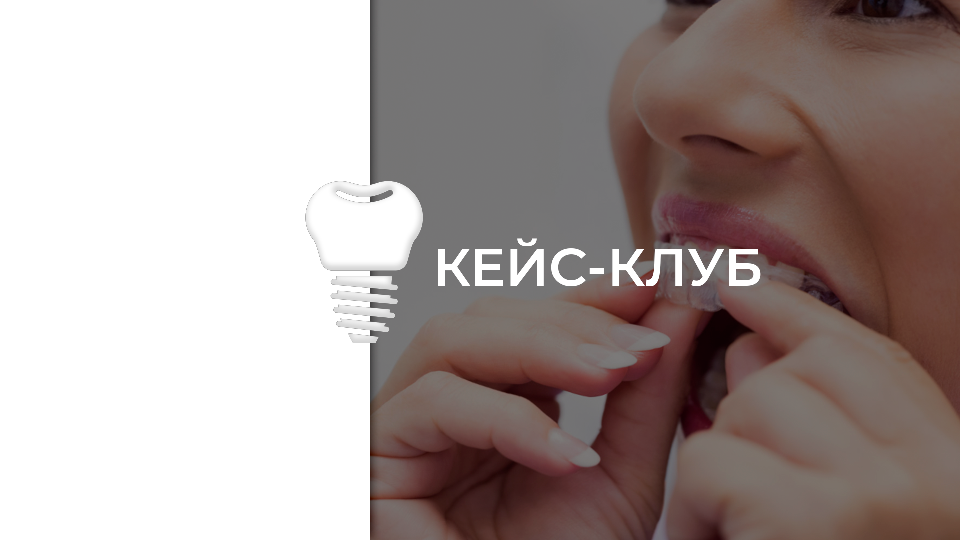 Кейс- клуб