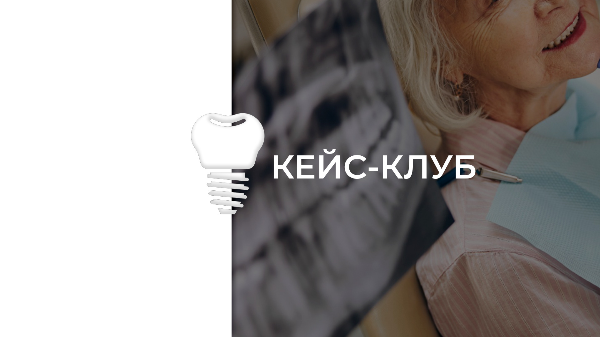 Кейс- клуб