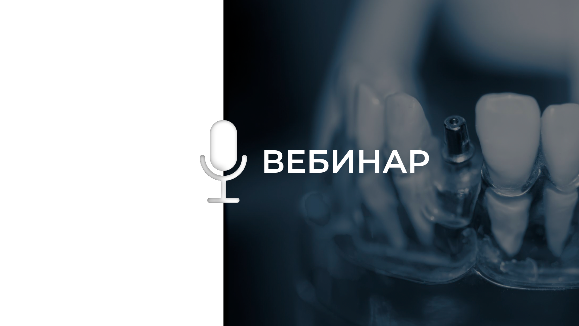 Костная пластика при дентальной имплантации. Простые решения в сложных случаях