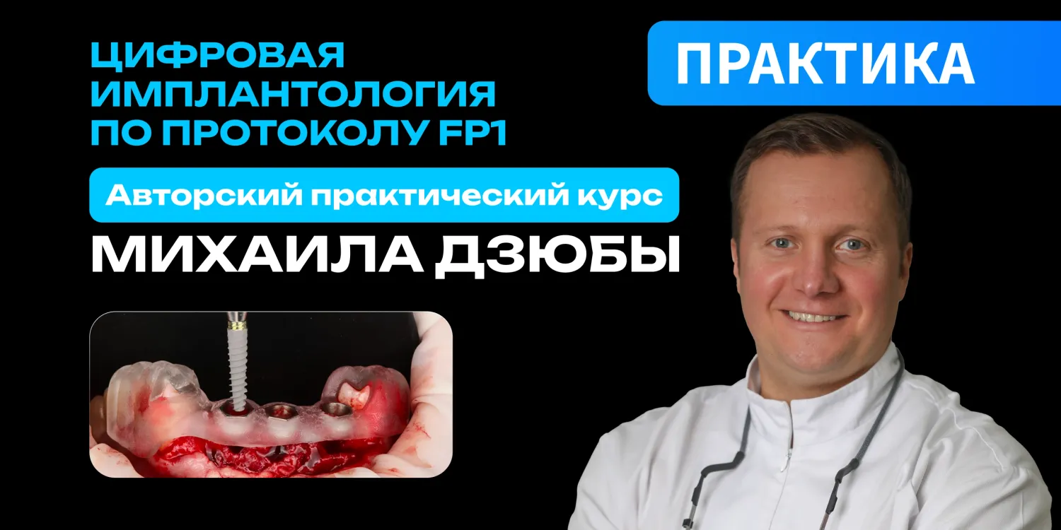 Цифровая имплантология по протоколу FP1
