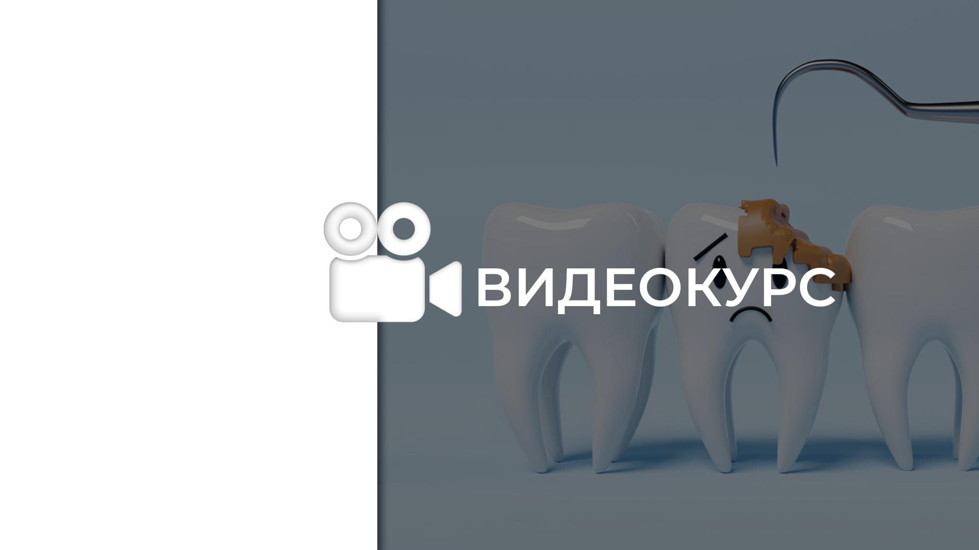 Кариес и некариозные поражения