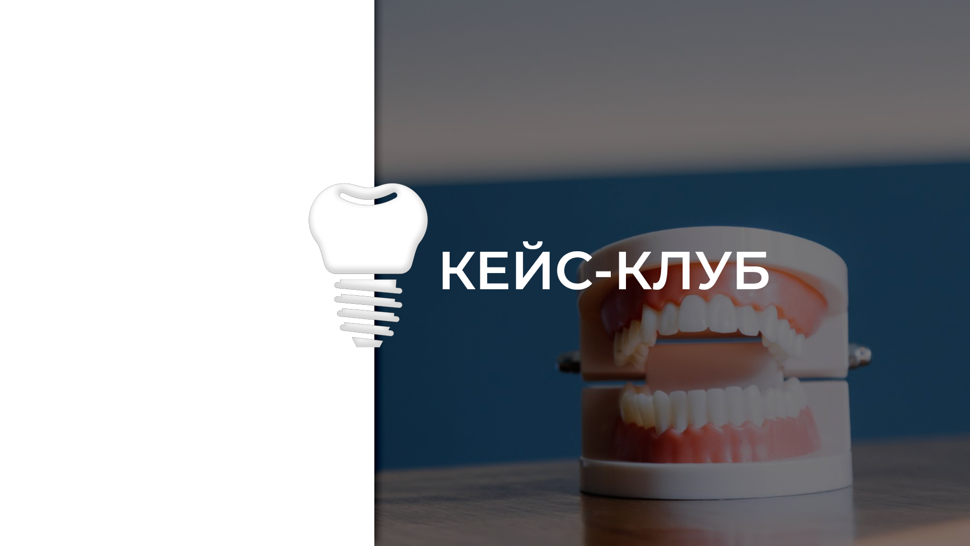 Кейс- клуб