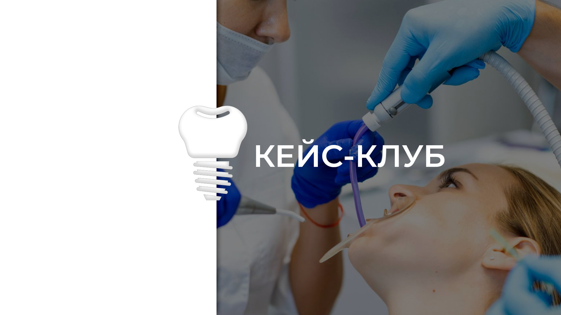 Кейс- клуб