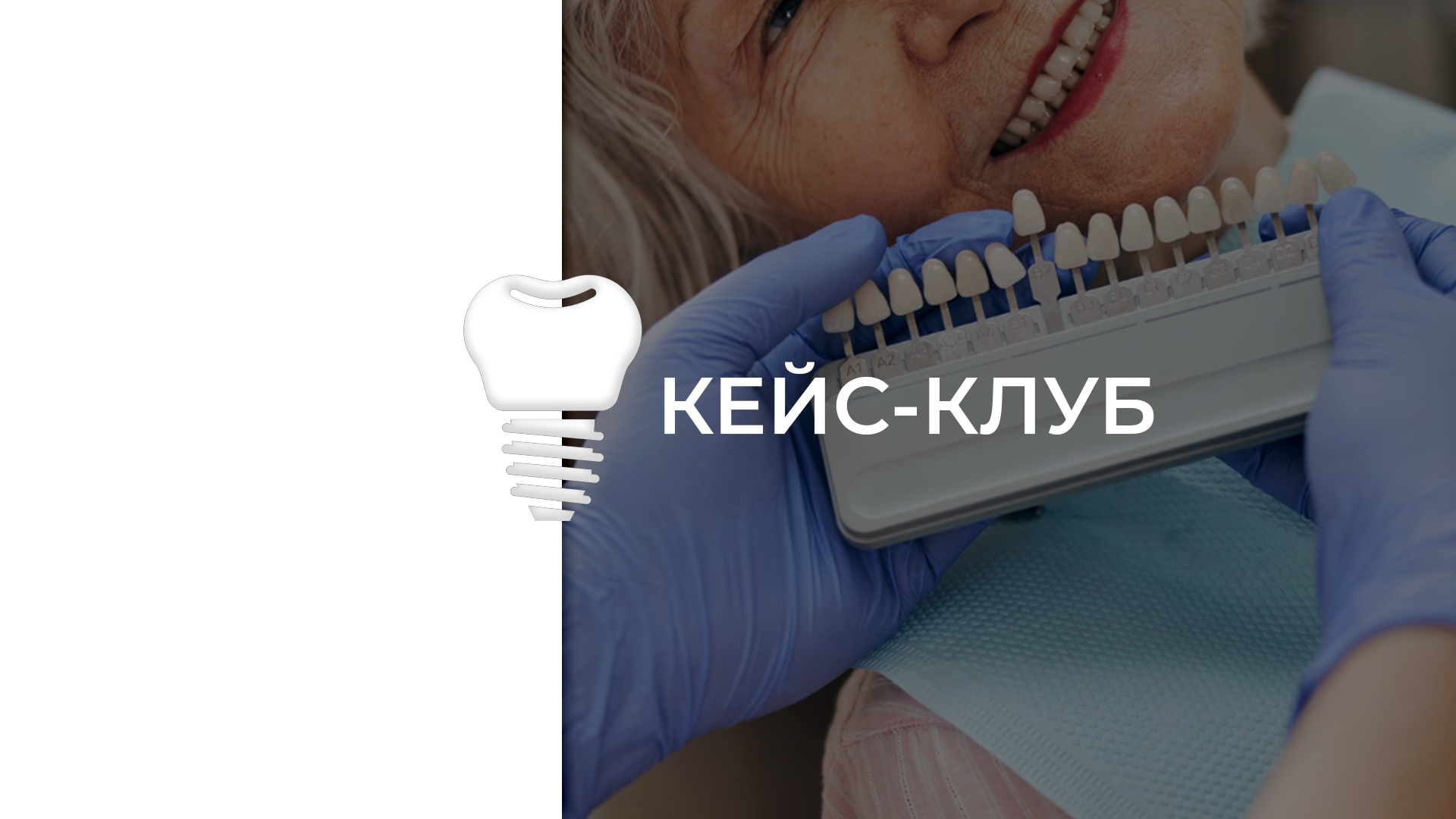 Кейс- клуб
