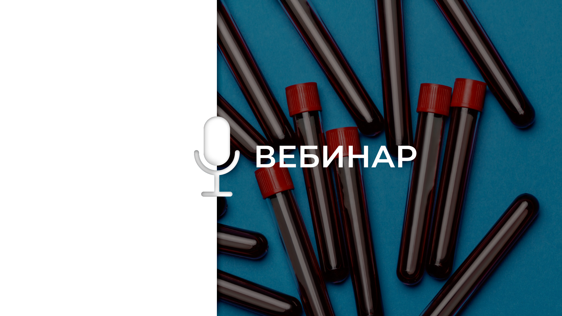 Настройка центрифуги для получения различных типов аутоплазмы