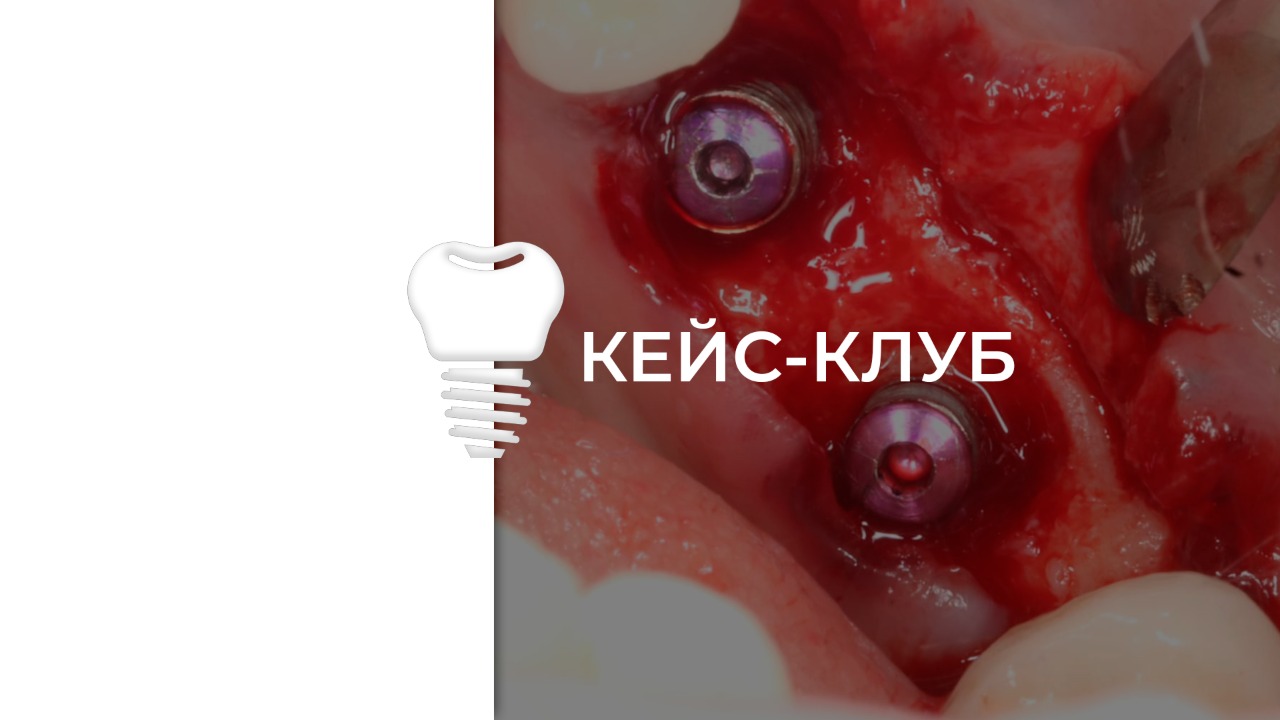Кейс- клуб. Всё на 4/6 в цифровом протоколе