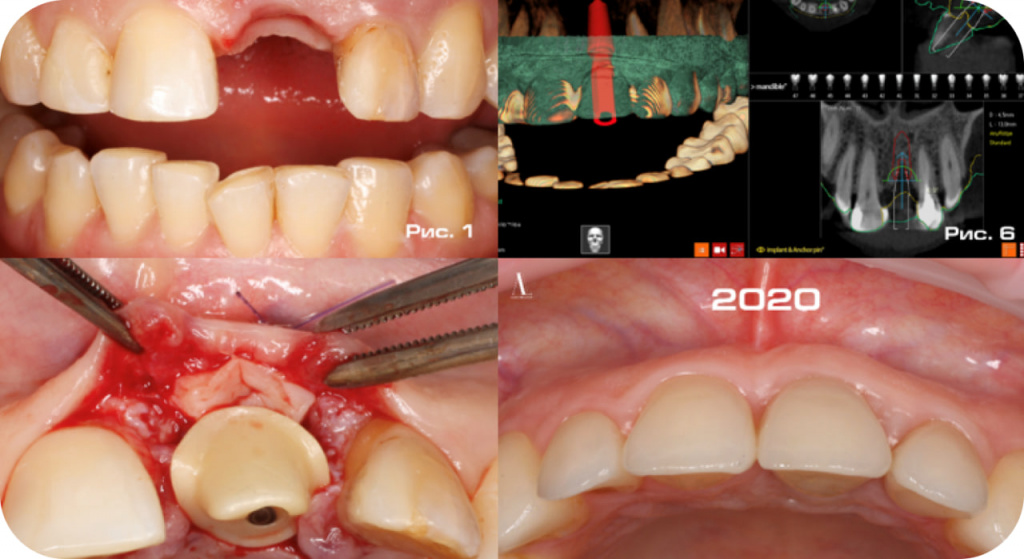 Clinical case