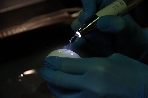 7 Продвинутый курс по имплантации. Костная пластика - общая галерея