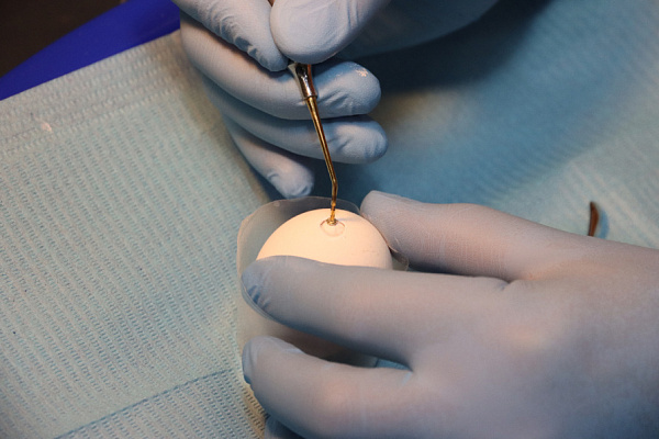 02.02. Продвинутый по имплантации 22 (10)