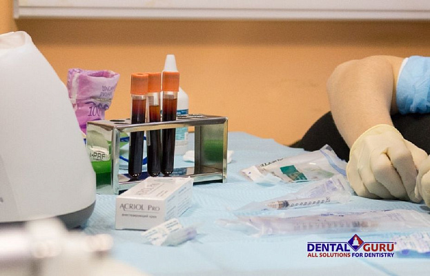 8 Плазмотерапия PRF в эстетической медицине - общая галерея