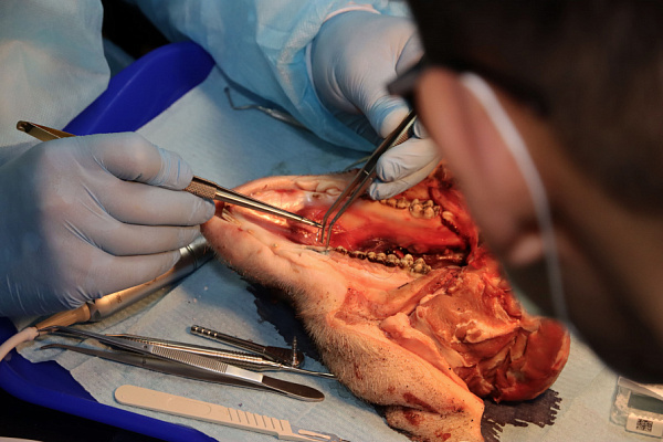 10 Продвинутый курс по имплантации. Костная пластика - общая галерея (4)