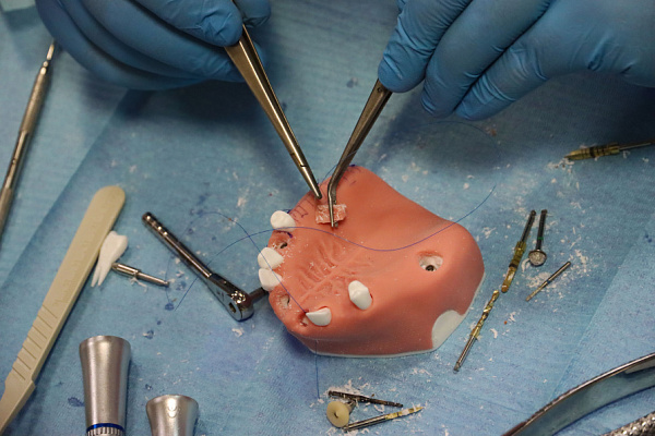 Одномоментная имплантация, немедленная нагрузка  (15)