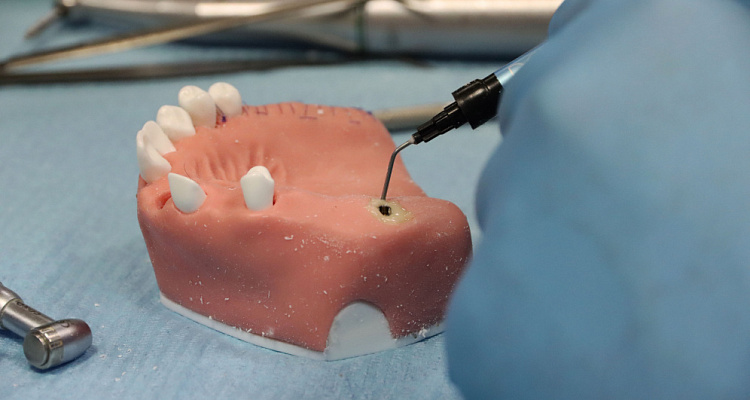 Одномоментная имплантация, немедленная нагрузка  (7)