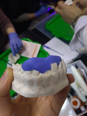 3 Прямые композитные виниры. Полный алгоритм и немного больше