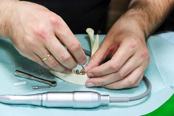 8 Экспертный курс по тотальной имплантации и протезированию при полном отсутствии зубов - общая галерея