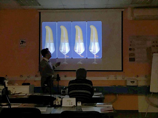 6 Продвинутый курс по эндодонтии. Перелечивание: сложности, которые решают - общая галерея