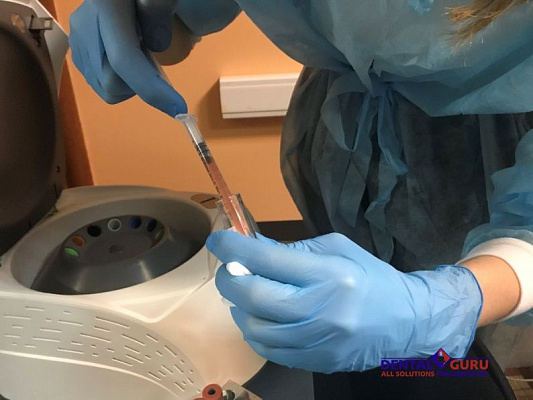 2 Плазмотерапия PRF в эстетической медицине - общая галерея