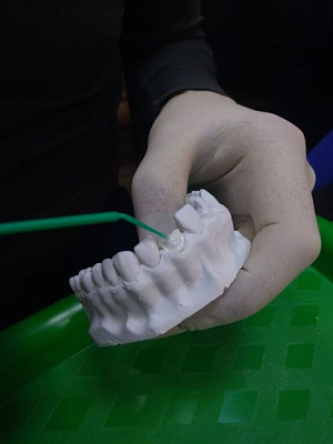 5 Прямые композитные виниры. Полный алгоритм и немного больше