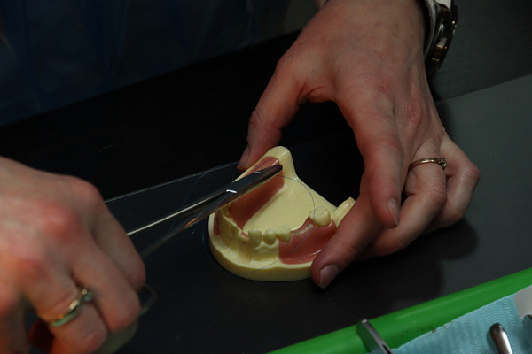 Швы применяемые при дентальной имплантации_ 5