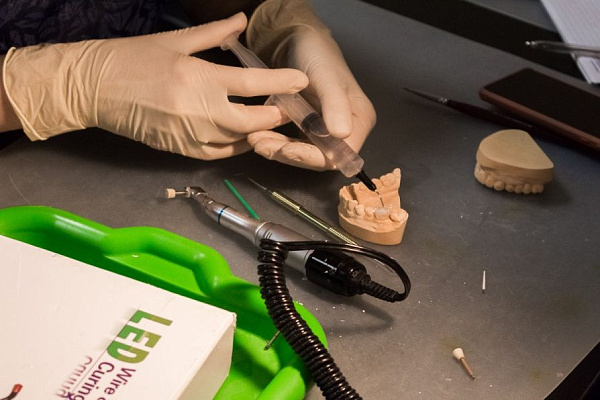 8 Прямые реставрации повышенной прочности. Эффективная альтернатива ортопедии: стекловолоконные каркасные конструкции - общая галерея