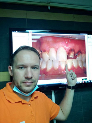 11 Секреты идеальной реставрации - общая галерея