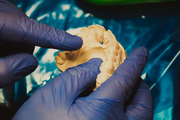 9 Секреты идеальной реставрации - общая галерея