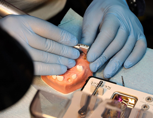 Одномоментная имплантация, немедленная нагрузка  (3)