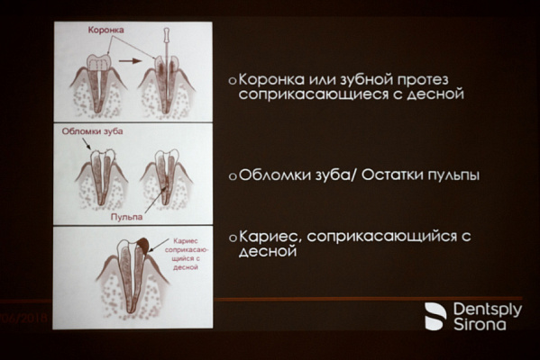 6 Cубъективно-объективная эндодонтия. Частые вопросы-простые решения - общая галерея