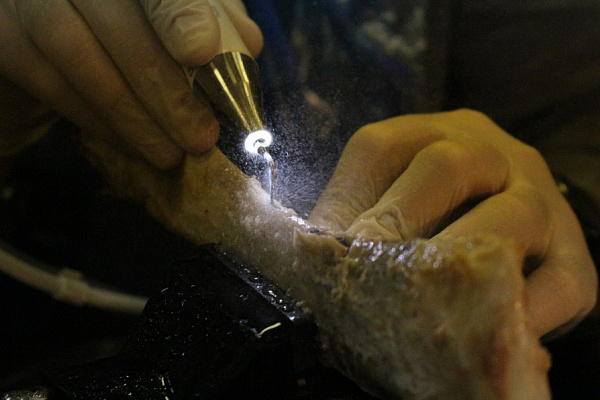 2 Продвинутый курс по имплантации. Костная пластика - общая галерея