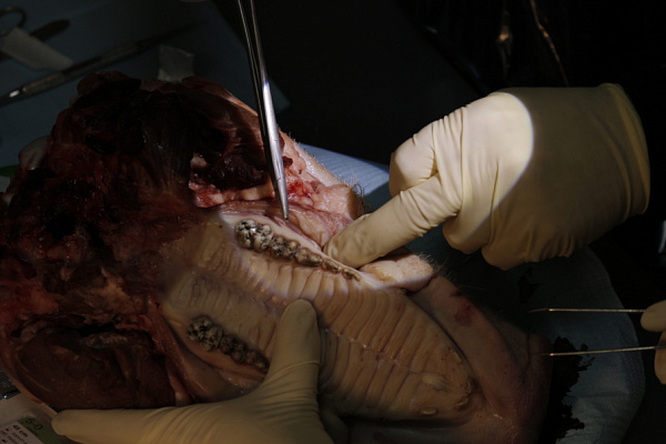 4 Пластика мягких тканей вокруг имплантатов. Морфологический подход - общая галерея