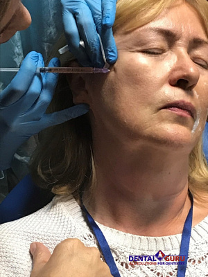 3 Плазмотерапия PRF в эстетической медицине - общая галерея