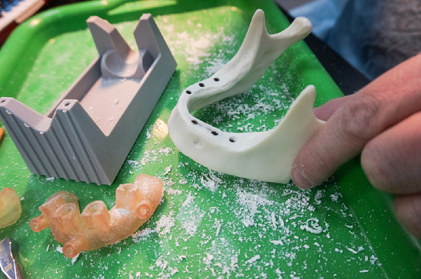 6 Экспертный курс по тотальной имплантации и протезированию при полном отсутствии зубов - общая галерея