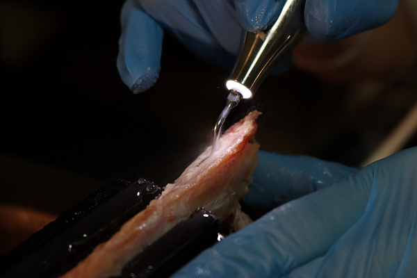 5 Продвинутый курс по имплантации. Костная пластика - общая галерея